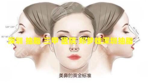 深圳 抽脂 三甲 医院 郑梦雄深圳抽脂